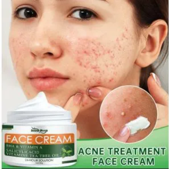 HEALTHY SHOP Anti-Acne Cream