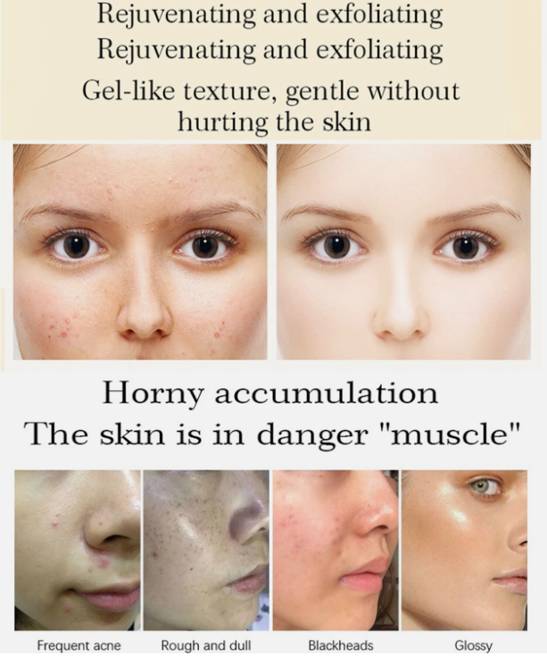 AICHUN BEAUTY Snail Peeling Gel Face Body Removes Skin Aging Deep Cleaning 100ml